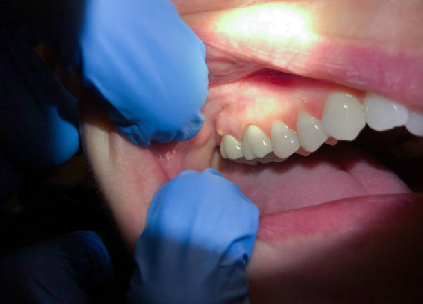 Best Emergency Gum Treatment in Faribault, MN