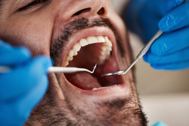 Best Pediatric Emergency Dentist in Faribault, MN